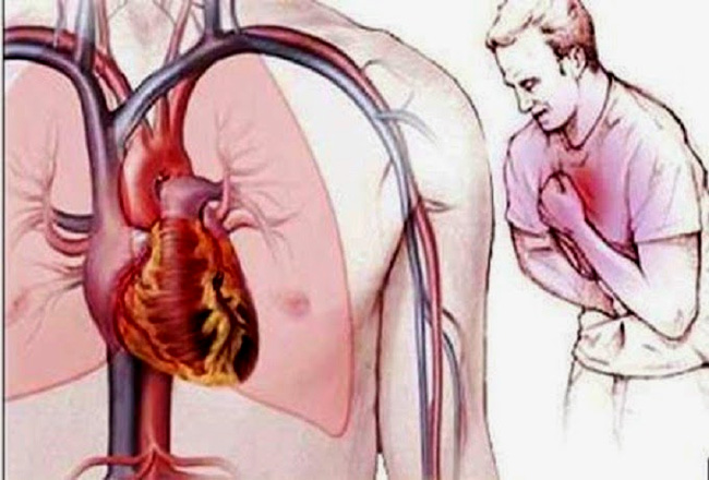 Đau ngực tái chủ yếu do các bệnh lý tim mạch